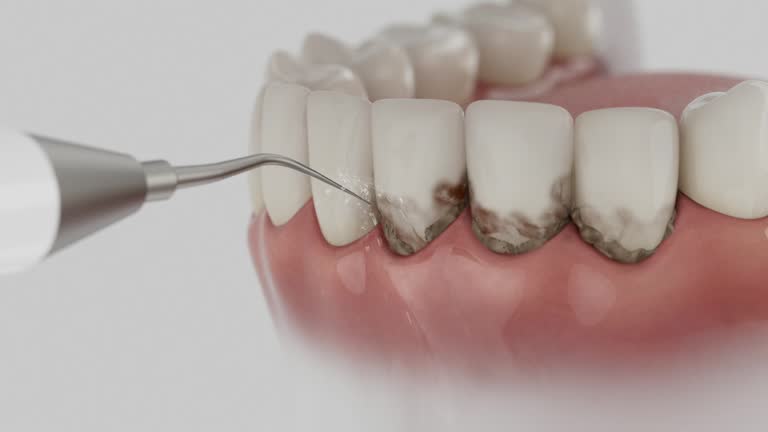 Reliable Dental Implants contractor in North Fork, CA by Smile Center Dentistry